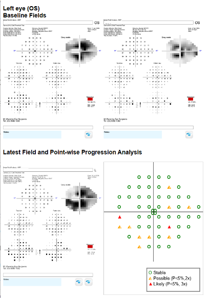 point progression